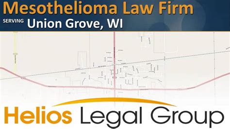 Union grove mesothelioma legal question - An attorney offering good mesothelioma legal advice will address every one of your concerns. According to an industry report published in April 2021 from KCIC, a consulting firm that …